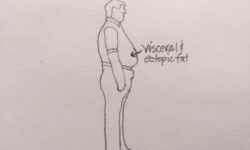 The Perils of Visceral and Ectopic Fat