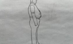 Obesity Redefined